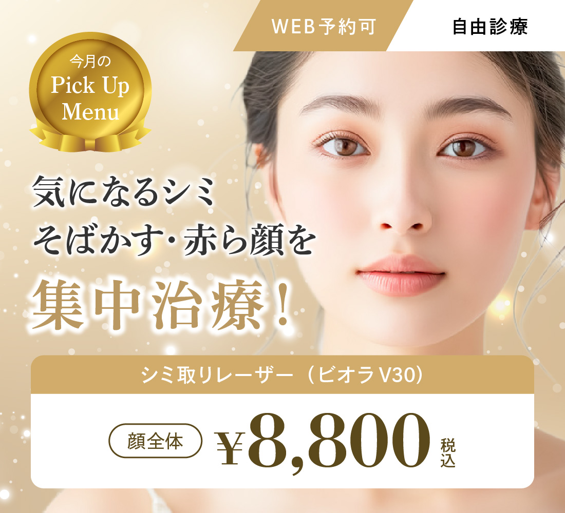 シミ取りレーザーキャンペーン